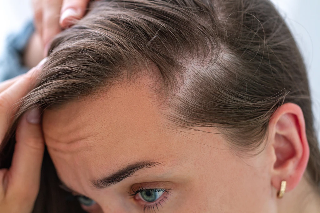 niksen tratamiento capilar caida del cabello